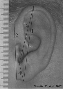 mesures de l'oreille